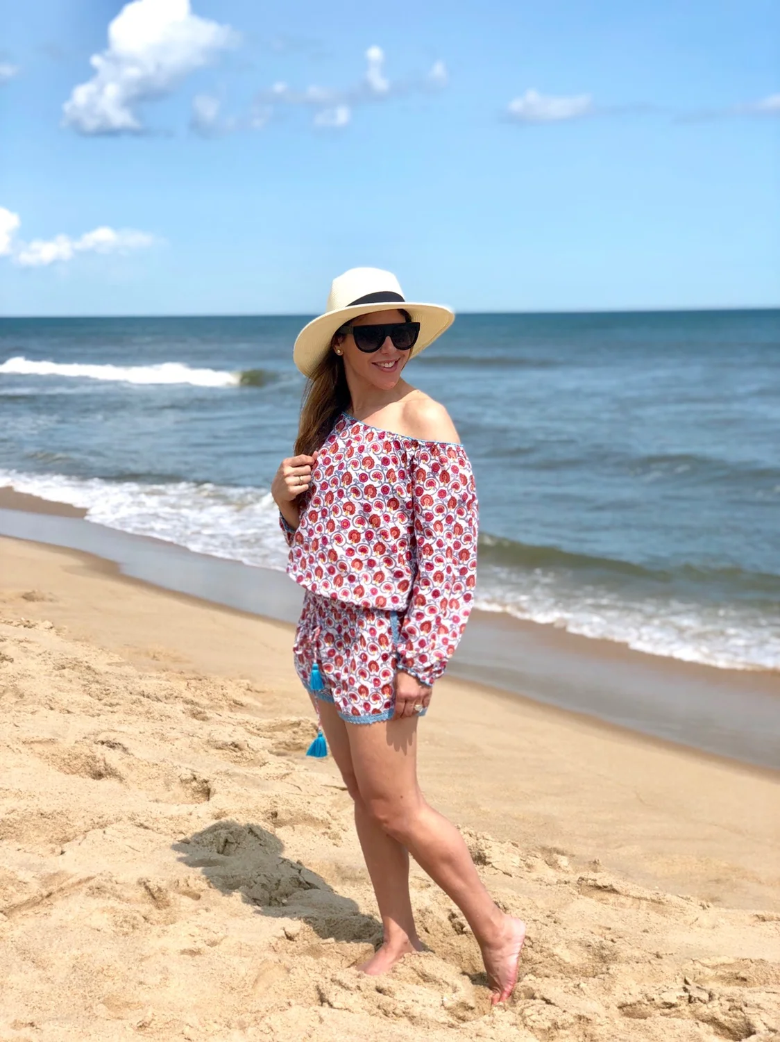 Sunburns happen, and here’s what to do afterwards