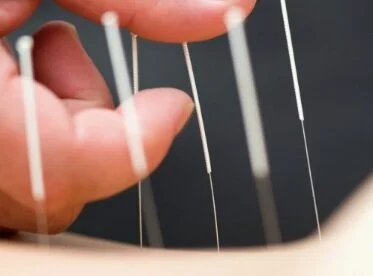 Why You Should Avoid Dry Needling