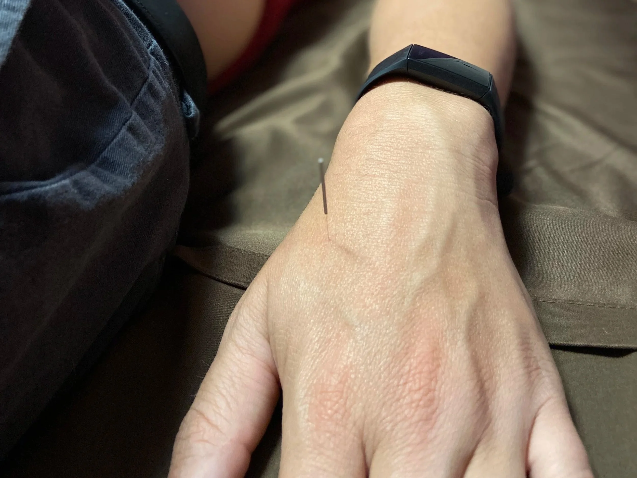 The 3 points your acupuncturist uses the most