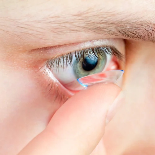 Contact-Lens-Examination.jpg