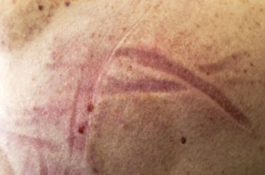 shoulder (small).jpg