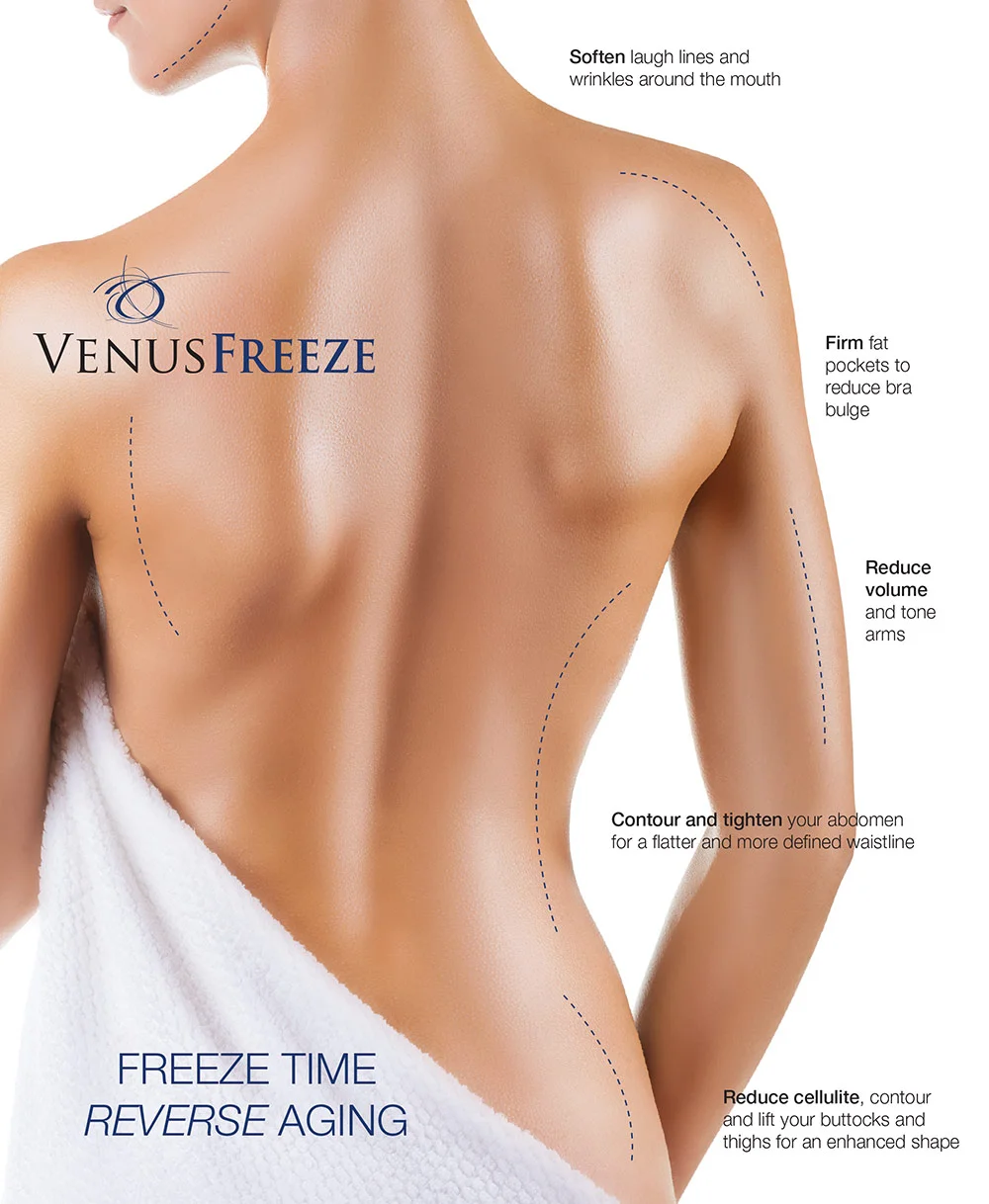 Venus-Freeze-Patient.jpg