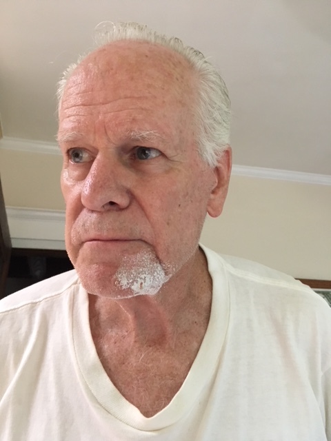 Hornet's Nest 2 Bitten.JPG