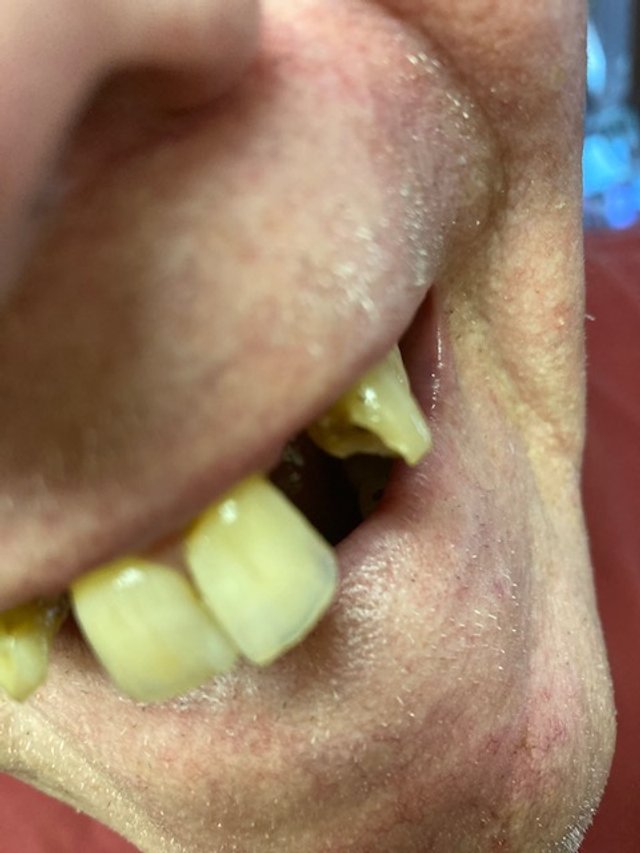 Teeth Issues 3.jpg