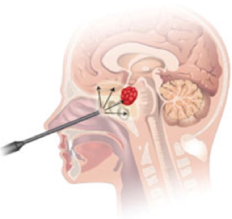 endoscope.jpg