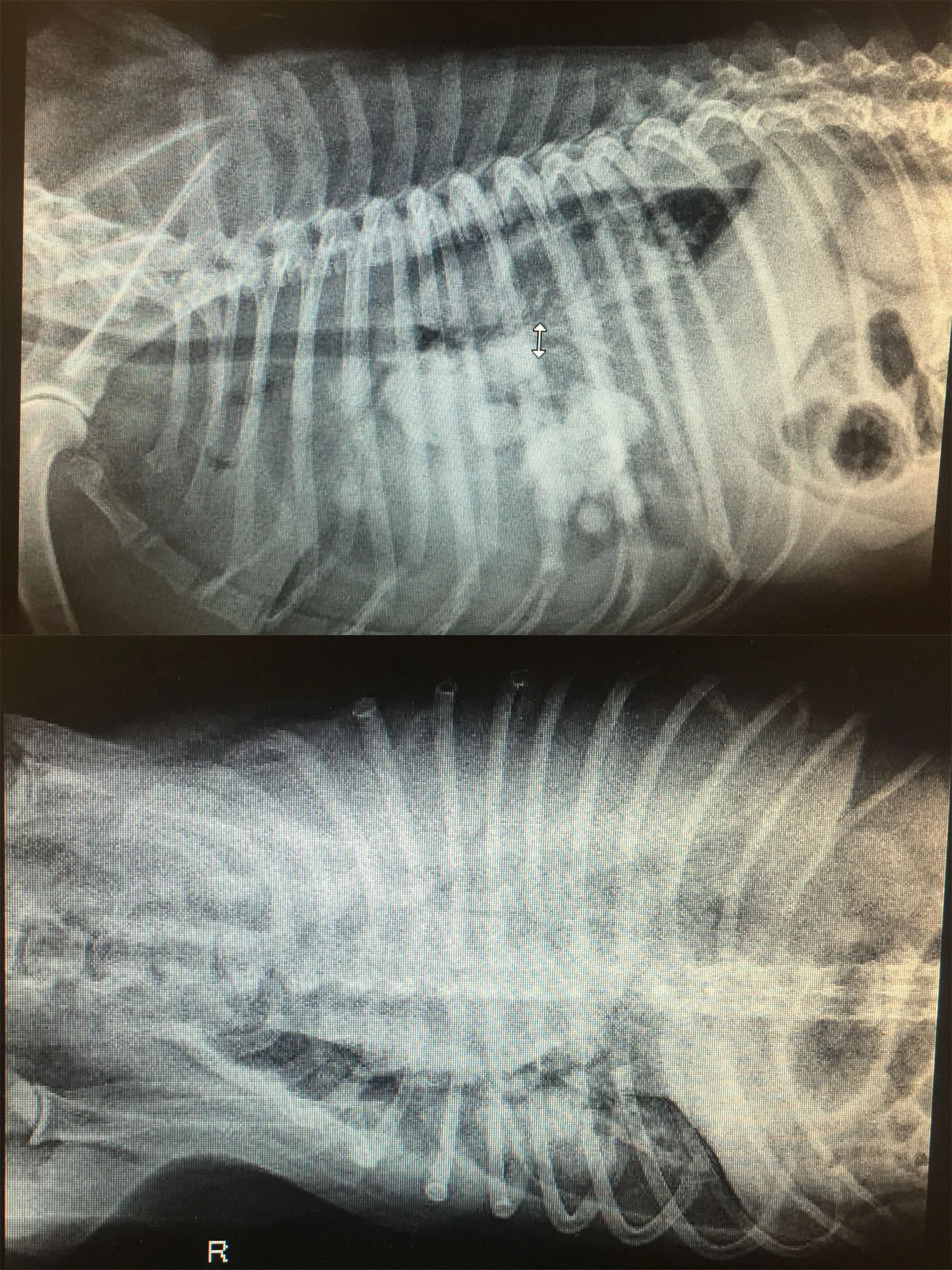 These are a couple of Gus's X-Rays. The one on the bottom shows that his left lung is basically all cancer. But we are fighting it...