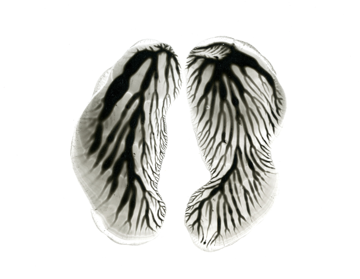 Lungs 1001 300 closeup.jpg