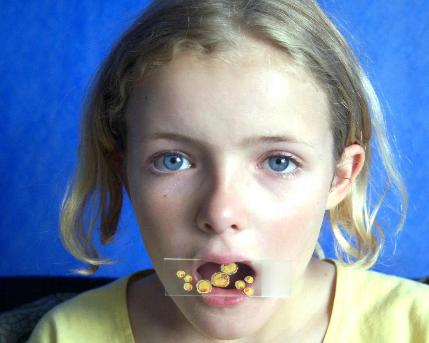 Spontaneous Generation: Renee - Malaria