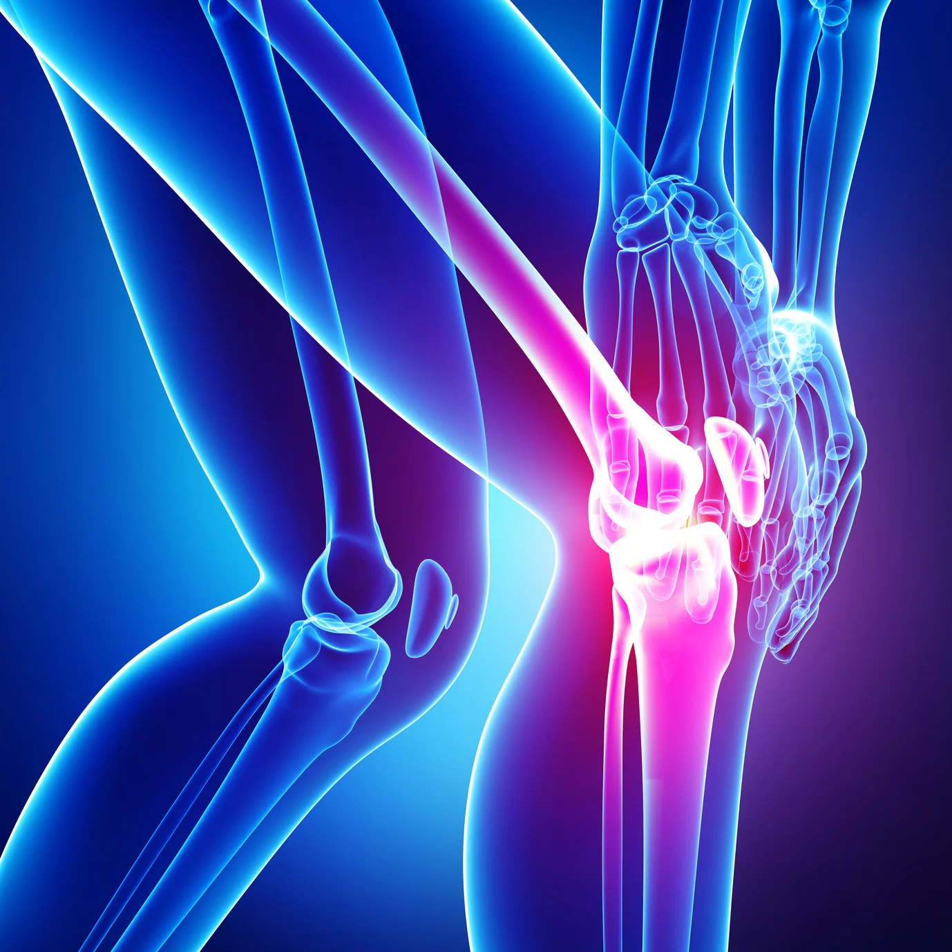 Exercise Tips for Adults with Arthritis