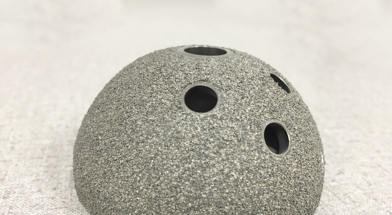 Hipper than Ever: Advancing Technologies Make Hip Replacements Viable for a Younger Population