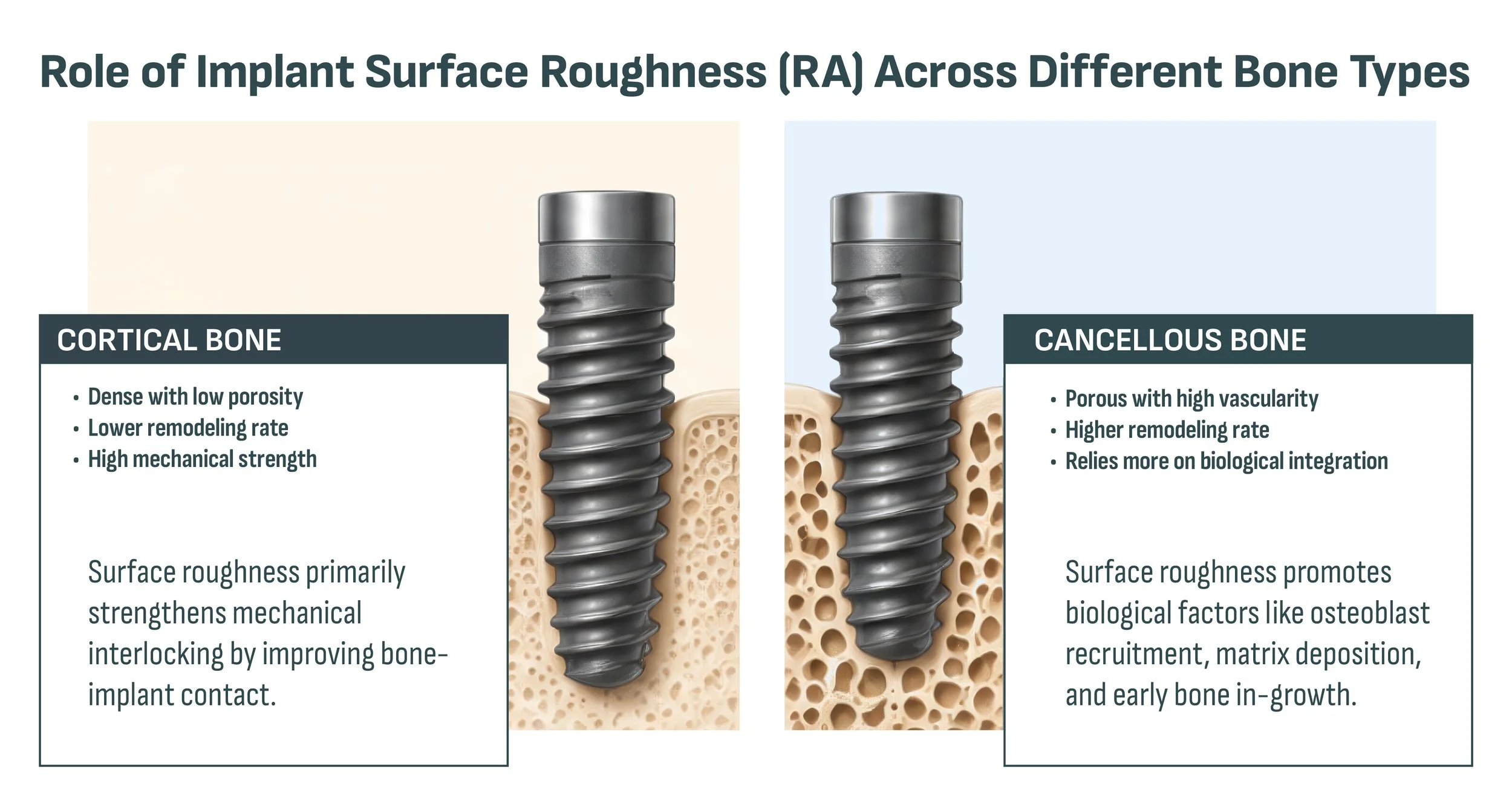 Infographic showing threaded medical implants inserted into cortical and cancellous bone with information about implant surface roughness impacts for integration with each bone type
