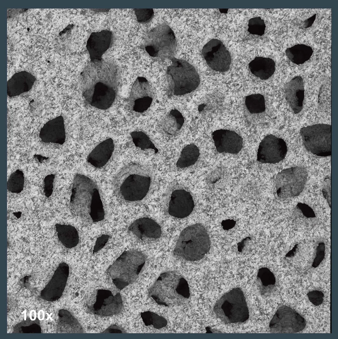 100x magnification of a titanium orthopedic implant blasted with aluminum oxide abrasive