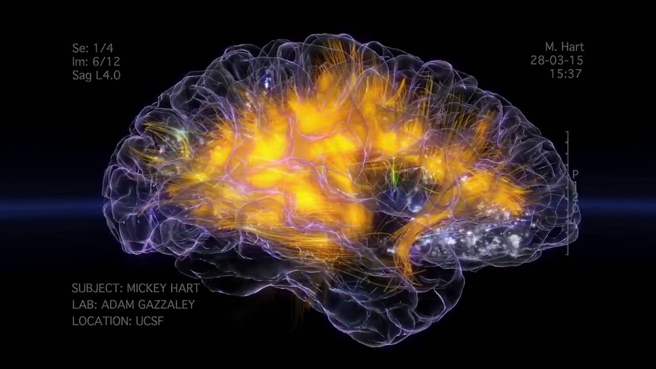 GazzaleyBrain.jpg