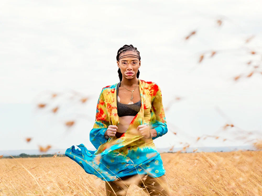 KOTHARI-Winnie_Harlow_077A7529.jpg