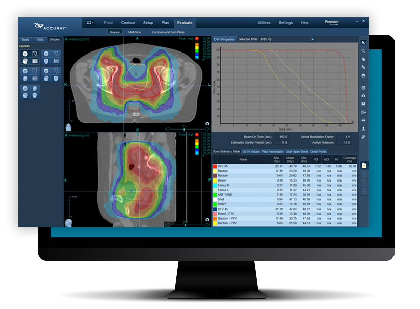 Radiation dosimeter software and treatment planning workstation.