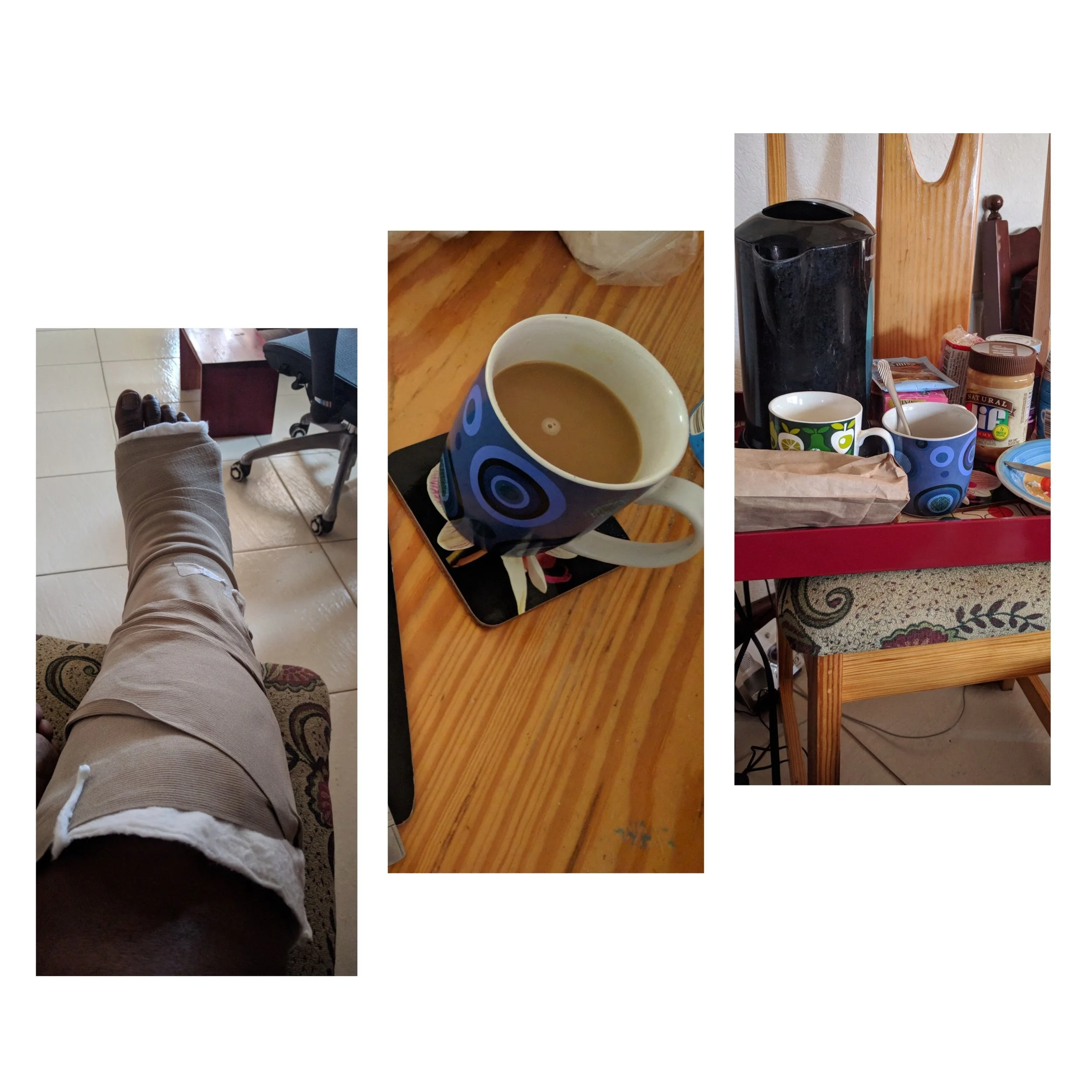 Crutches and Coffee - I fractured my ankle yesterday