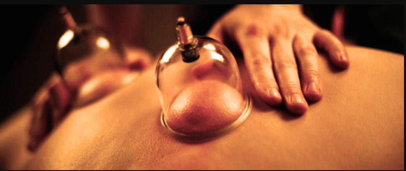Cupping-Massage-Cocoa-Beach-Fitness-Therapy.jpg