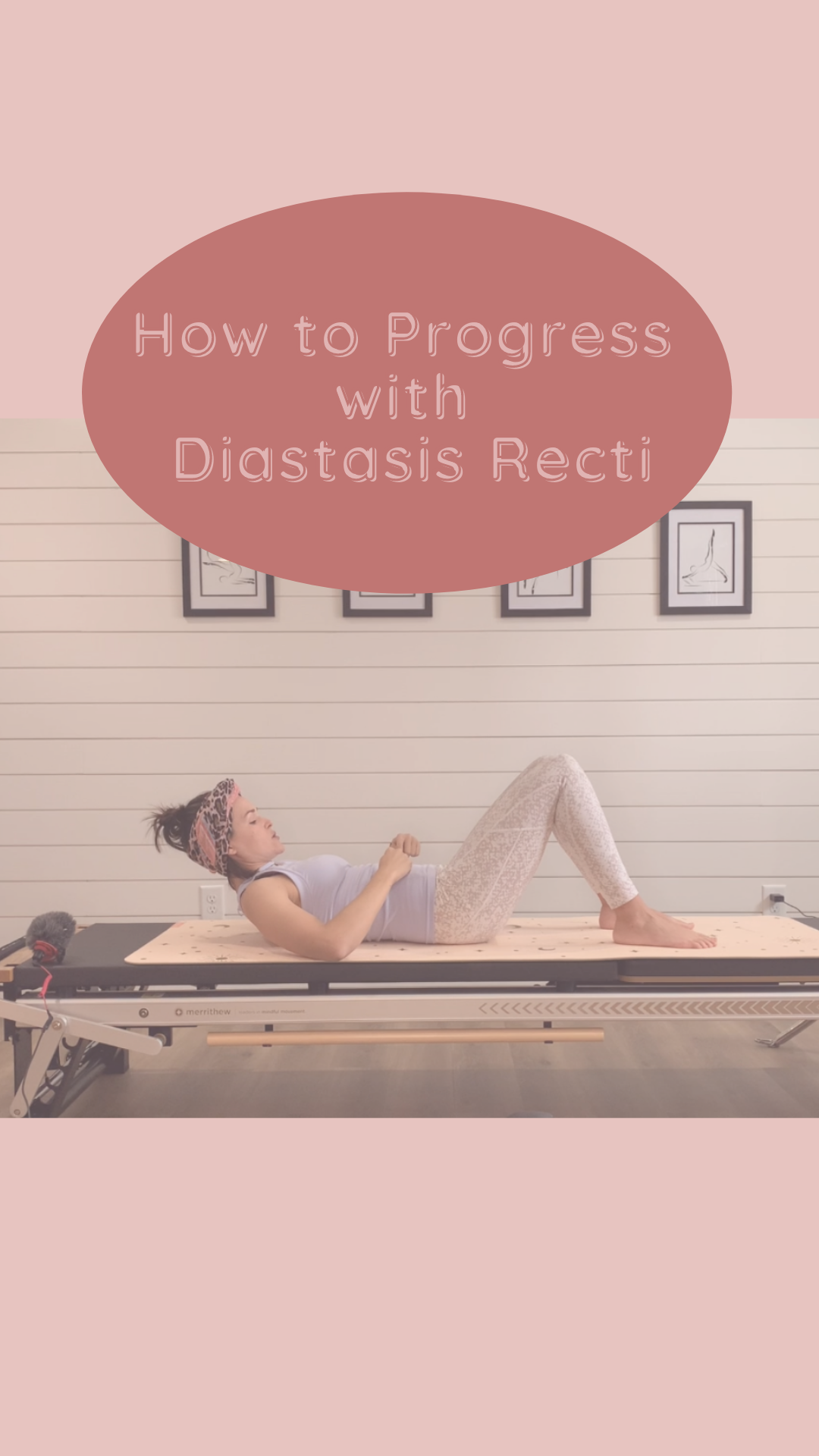How to Progress Exercise with Diastasis Recti