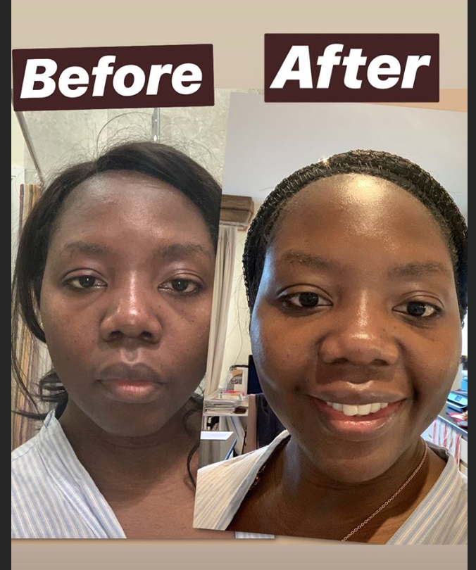 Peel2Glow results.jpeg.png