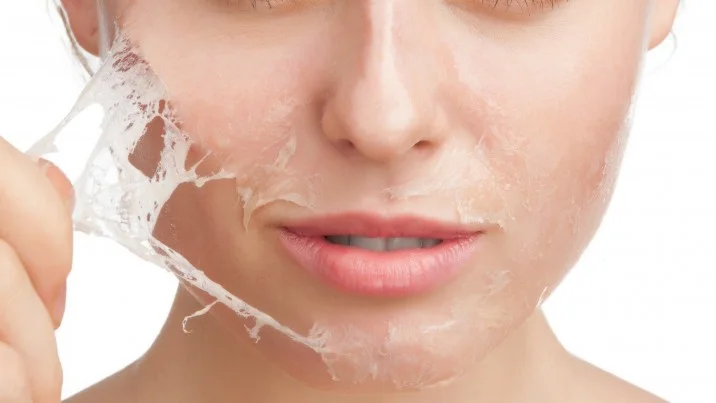 chemical-peel-philadelphia.jpg