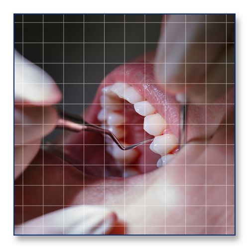 Alpharetta Dentist Advanced Cosmetic & Family Dentistry