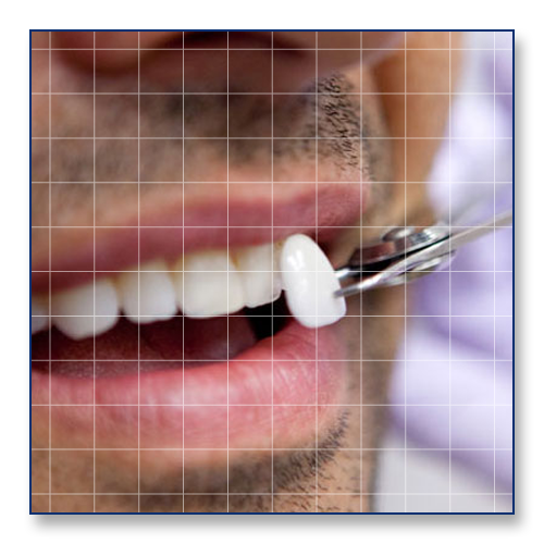 Alpharetta Dentist Advanced Cosmetic & Family Dentistry