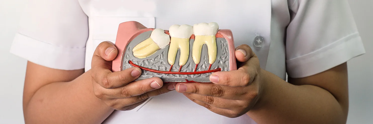 wisdom-teeth-banner.jpg