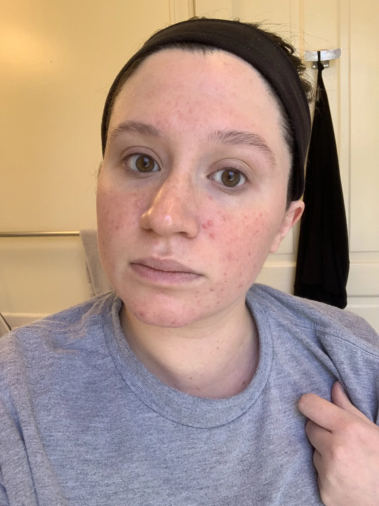 tula skincare before and after