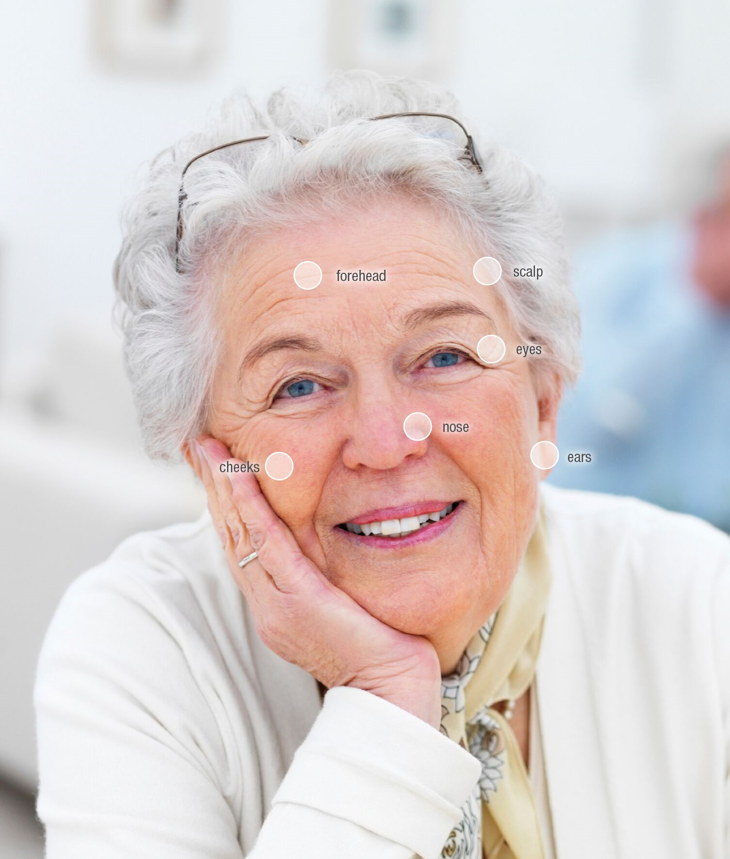 Elderly Woman with skin eBx targeted treatment areas.png