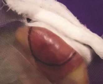 8th Treatment