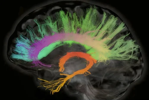 Colorful Brain.jpg