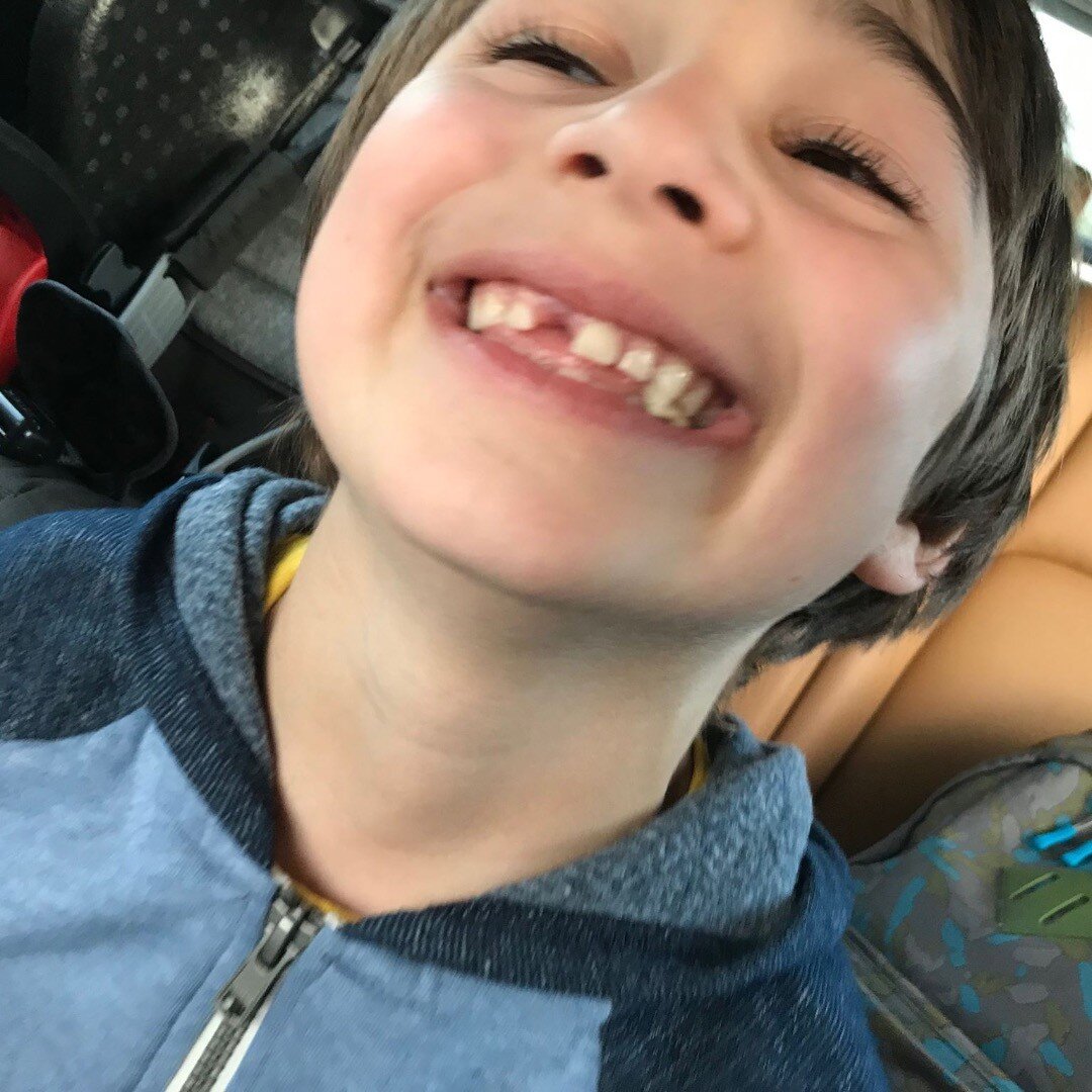 Mom's caption: Our guy lost his 3rd tooth! ❤️😍 Dad's caption: Our kid is ready for the NHL draft! 🏒🏉⛸🥅 #suckerforthiskid