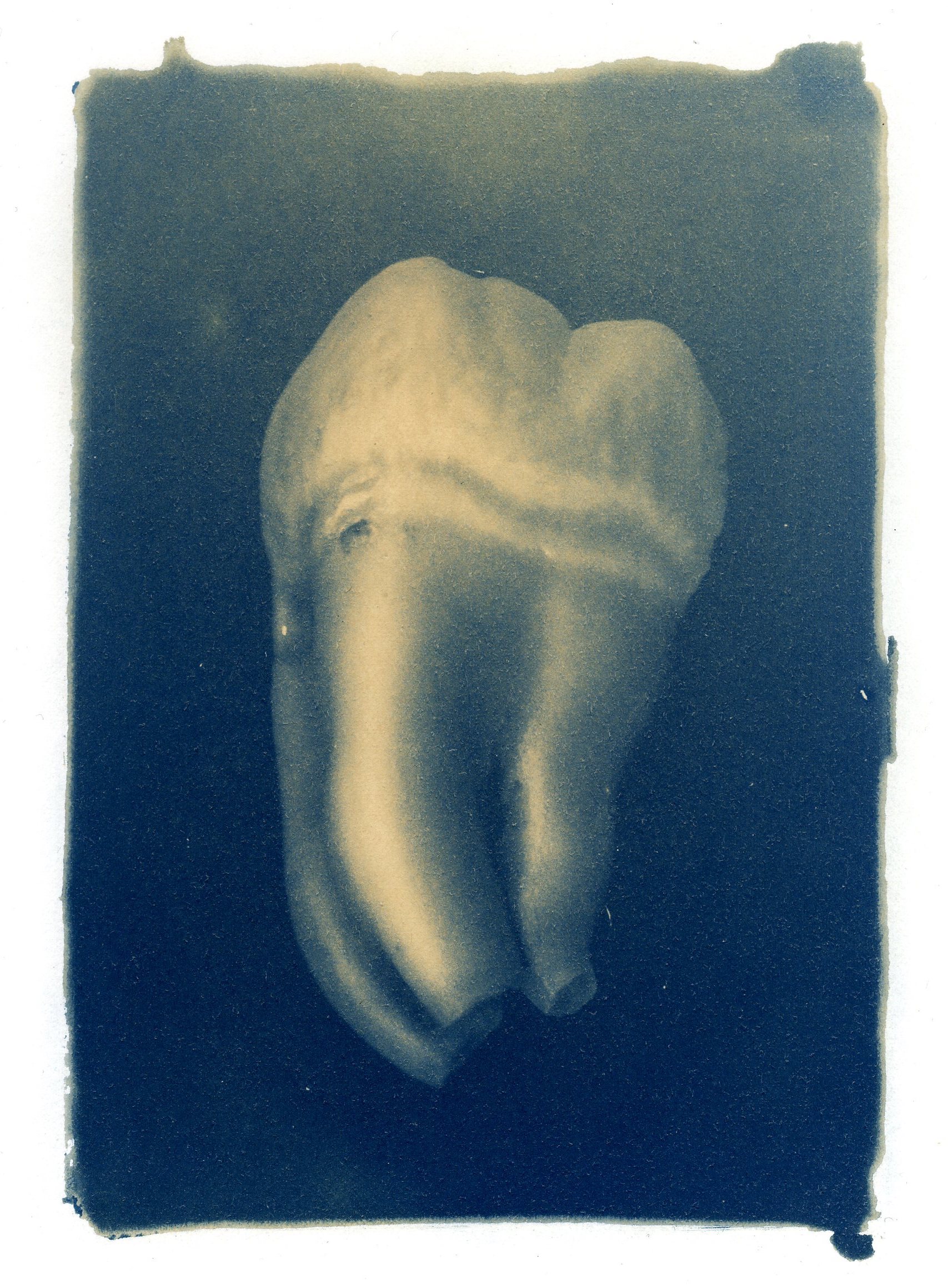 jcondon_teeth001.jpg