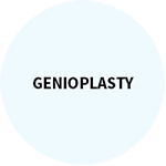 Genioplasty.png