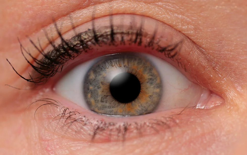 What do you see with Symfony lenses, after lens replacement surgery?