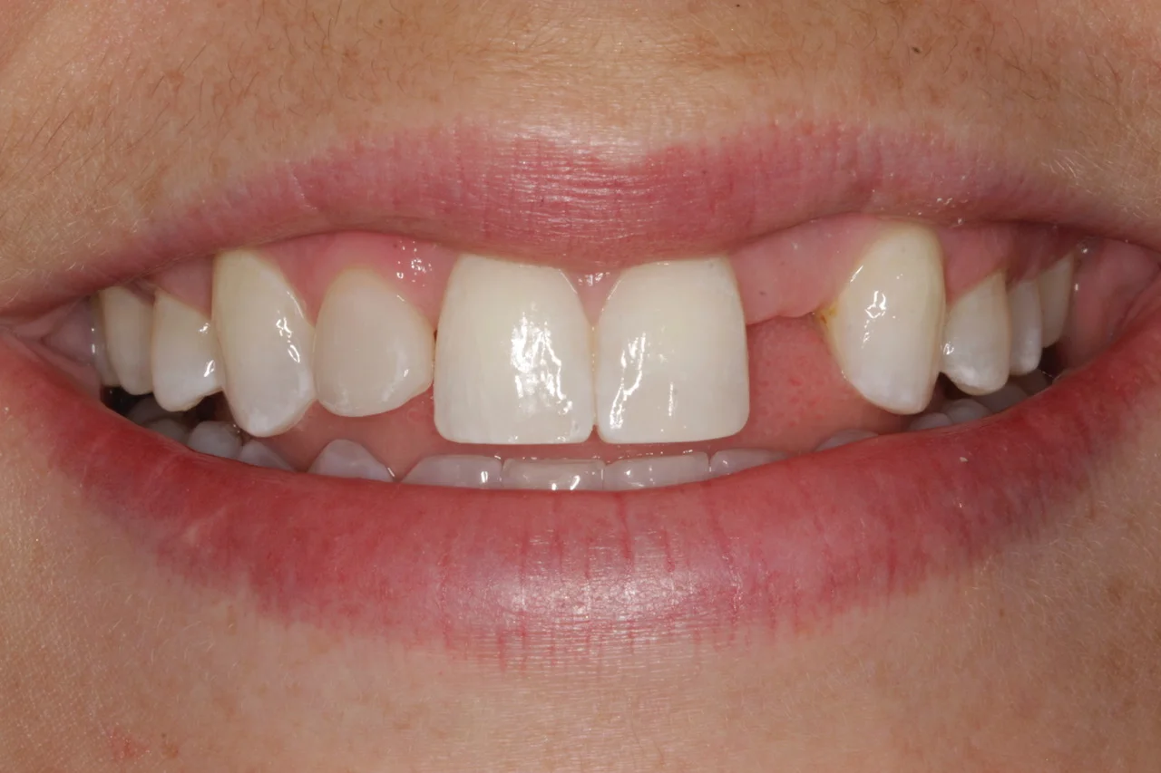 Palmetto Dental Associates — Dental Implants Lexington SC Columbia SC