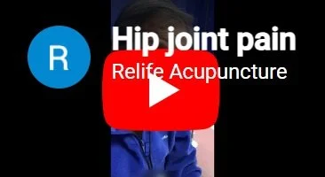 Acupuncture treatment for hip joint pain.