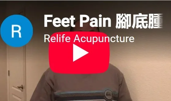 Acupuncture treatment for feet pain.