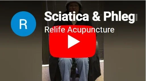 Acupuncture treatment for knee pain and sciatica.
