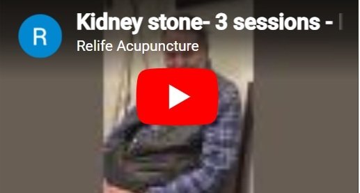 Acupuncture treatment for kidney stone.