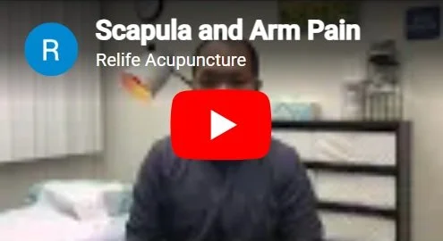 Acupuncture treatment for scapula and  arm pain.