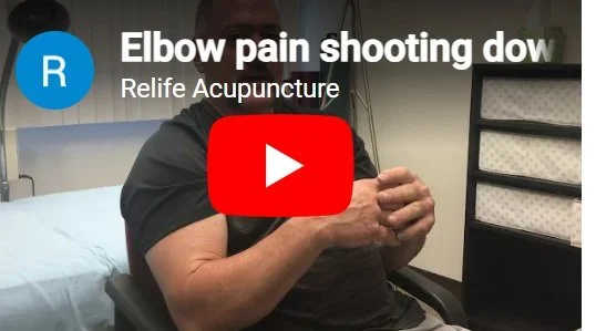 Acupuncture treatment for tennis elbow pain.