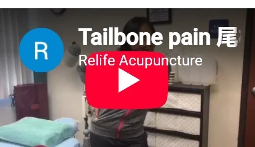 Acupuncture treatment for tailbone pain.