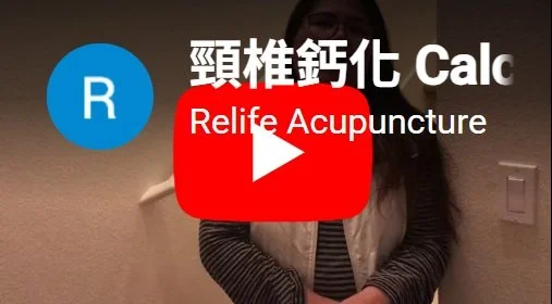 Acupuncture treatment for calcification of neck, associated tingling limbs and back pain.