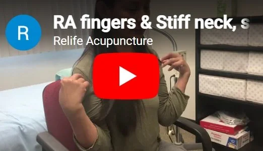 Acupuncture treatment for RA tight fingers, stiff neck, shoulder and knee pain.