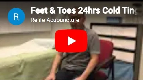 Acupuncture treatment for feet and toe tingling.