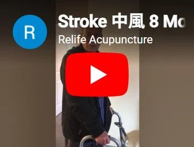 Acupunctrue treatment for stroke.