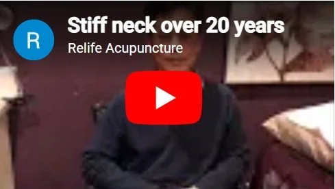 Acupuncture treatment for stiff neck.