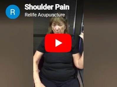 Acupuncture treatment for shoulder pain.