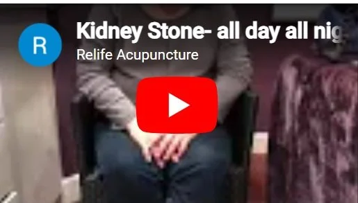 Acupuncture treatment for kidney stone.